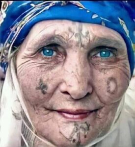 berber tatoeage, amazigh tatoeage, marokko tatoeage, tatoeage verwijderen, berber tattoo removal, tattoo removal zoetermeer, tatoeage verwijderen zoetermeer, kin tatoeage verwijderen