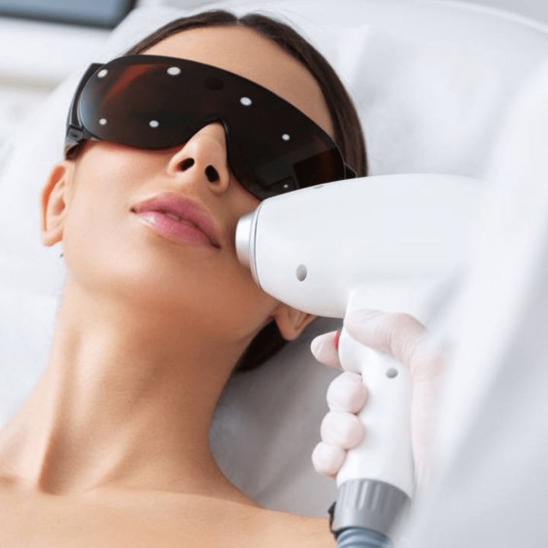 laserontharing gezicht maas huidtherapie, vergoeding laseren, vergoeding laser ontharen, vergoeding laserontharing, huidtherapie laserontharing, vergoeding huidtherapie