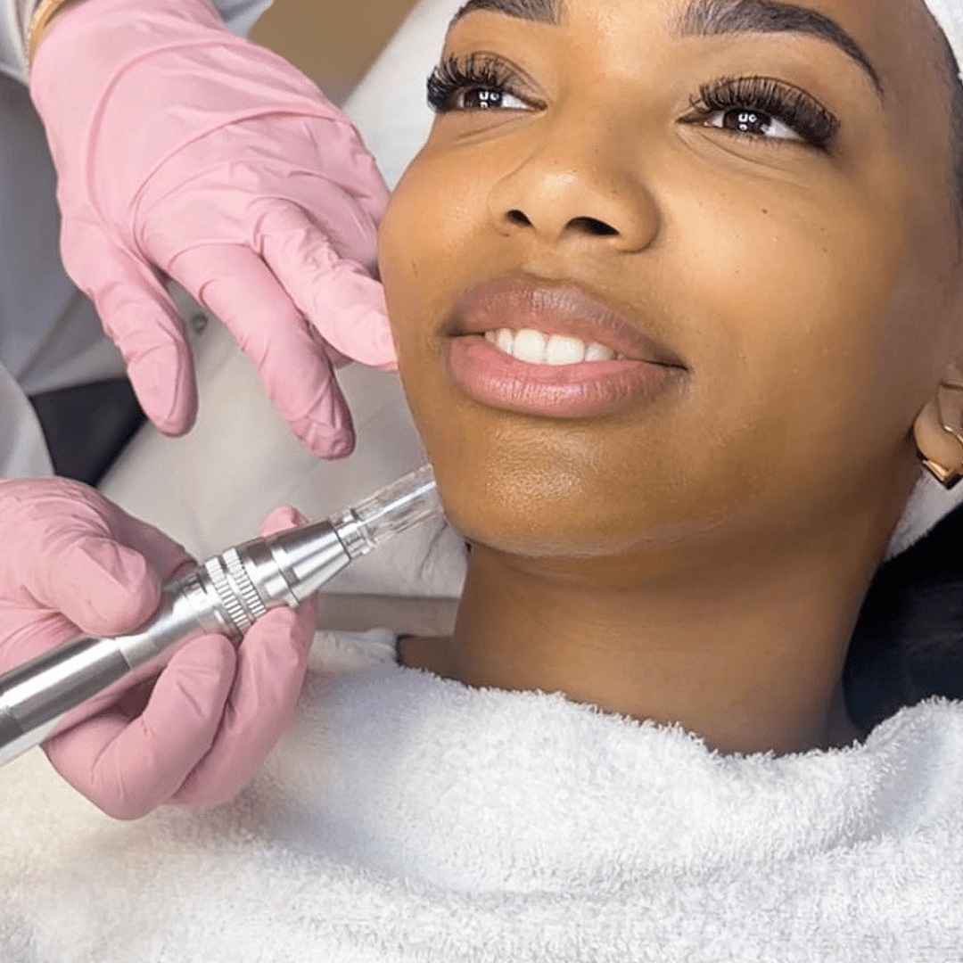 microneedling maas huidtherapie zoetermeer dermapen