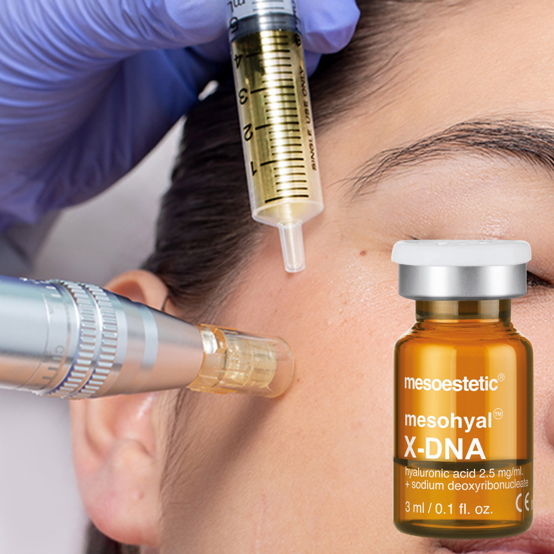 salmon dna facial, zalm dna behandeling, polynucleotiden behandeling, microneedling acnelittekens littekens gezichtsbehandeling zoetermeer beauty skin care huidtherapie huidbehandeling pigmentvlekken zwangerschapsmasker rosacea vergoeding aanvullende zorgverzekeraar haarverlies alopecia behandeling sproeten couperose werking cz zekur menzis vgz nationale nederlanden