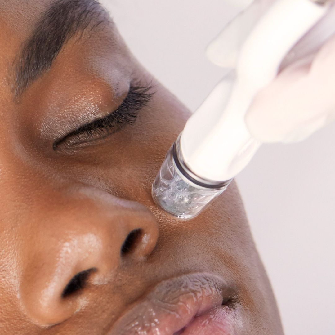 hydrafacial zoetermeer, hydrafacial maas huidtherapie